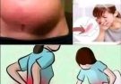 These are the signs  that it is gro…..Read More