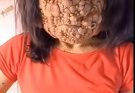 💔😨Acne occurs when hair follicles become clogged.