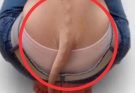 The World’s Thinnest Woman’s Battle Against Anorexia Will Leave You Speechless!