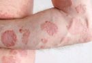 These are the consequences of sleeping with the…See more