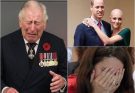 TRAGEDY STRIKES! King Charles announces the name of the ‘type of cancer’ that Kate has just undergone surgery for: ‘It’s similar to mine; we both suffer from…