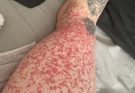 These are the consequences of sleeping with many…see more