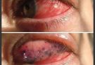 The Real Consequences of Sleeping With…